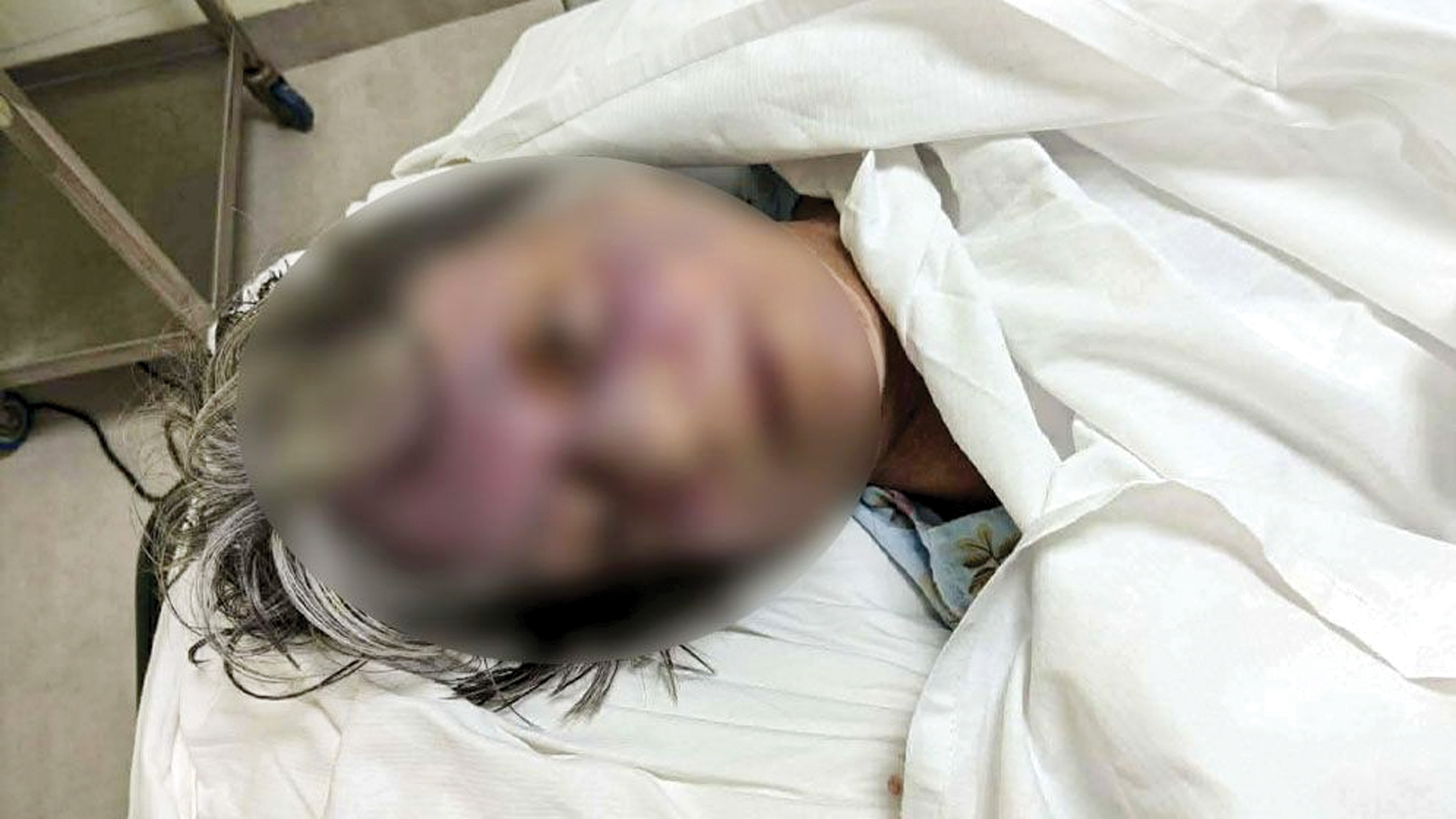 রাজধানীর গুলশানে বিদেশি নাগরিককে পিটিয়ে হত্যা