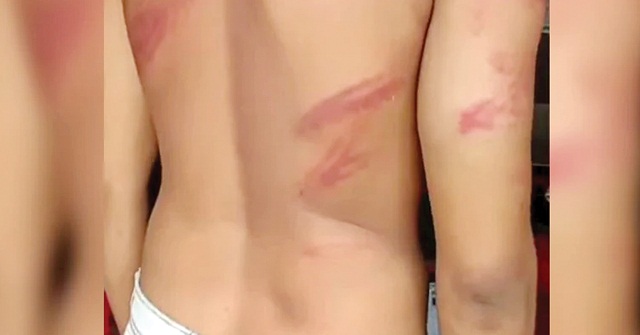 চুরির অপবাদ দিয়ে তরুণকে গাছে বেঁধে তরুণকে নির্যাতন