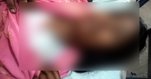 উজিরপুরে প্রতিপক্ষের হামলায় গৃহবধূ আহত 